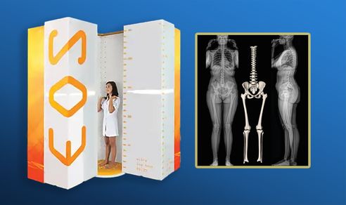Sistemul EOS este la MedysSportLine